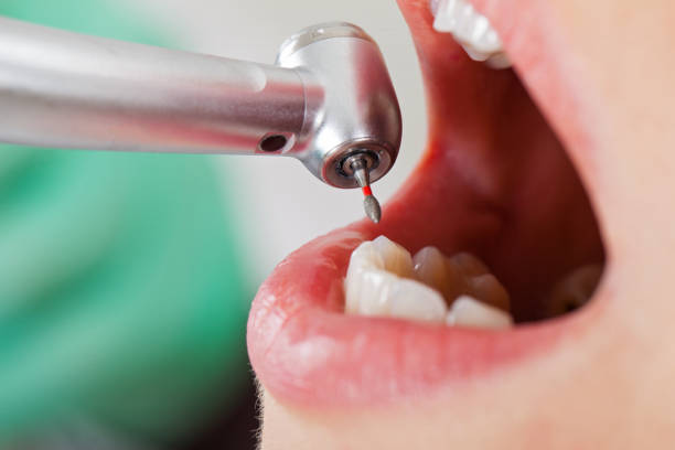 Best Cosmetic Emergency Dentistry in Overland Park, KS